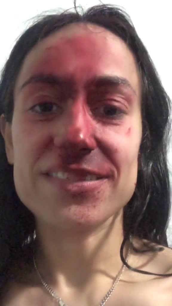 Woman Accidentally Colors her Face Red While Trying to Open Spray Paint Can